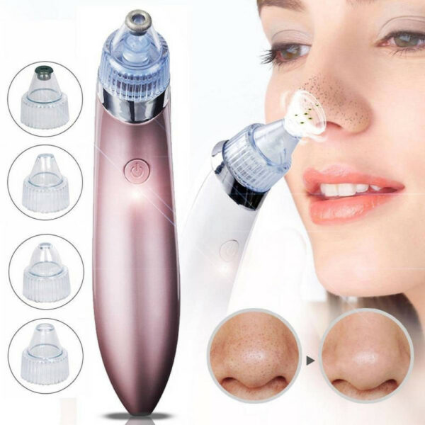 Electric Blackhead Acne Oil Remover Vacuum Suction Face Pore Cleaner